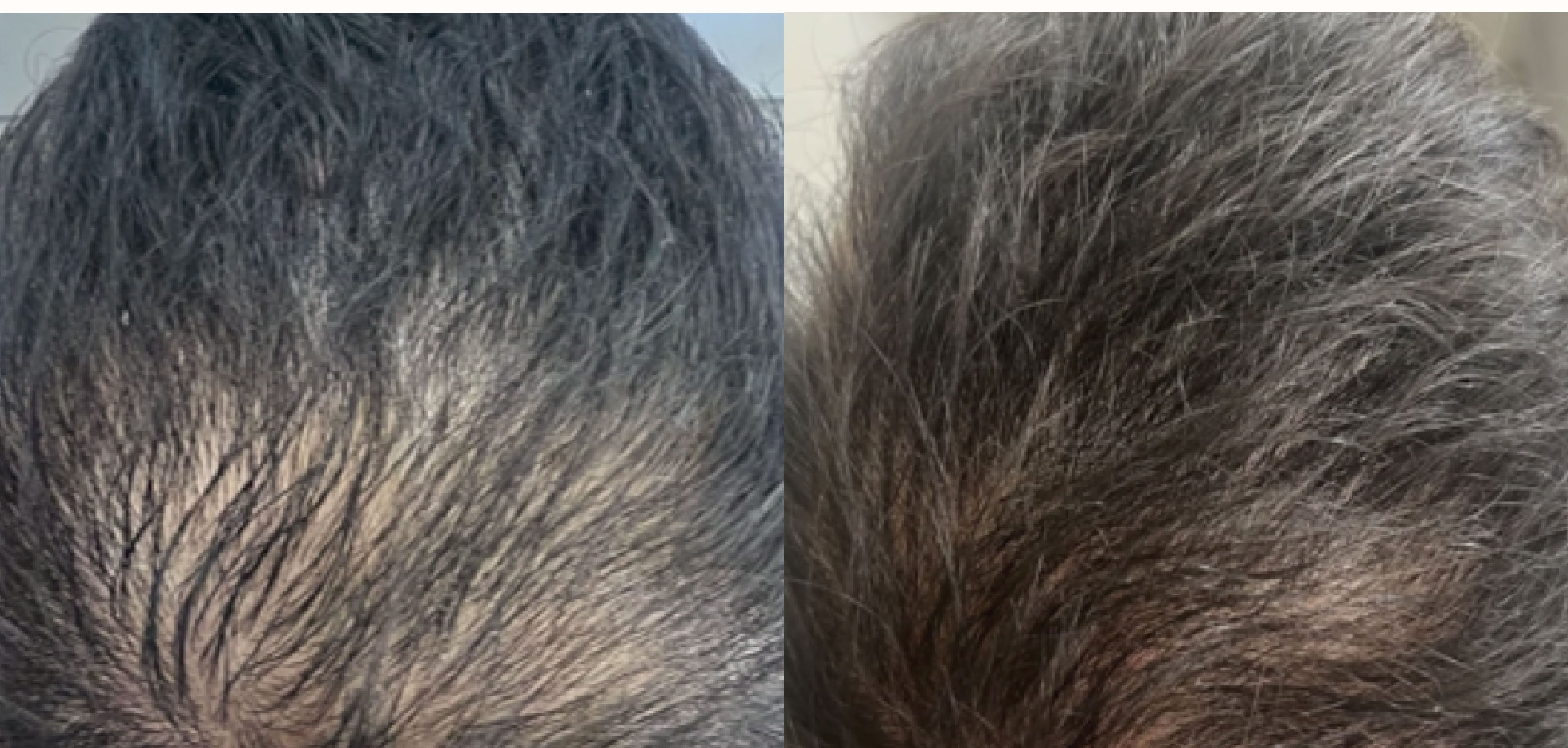 Scalp treatment results